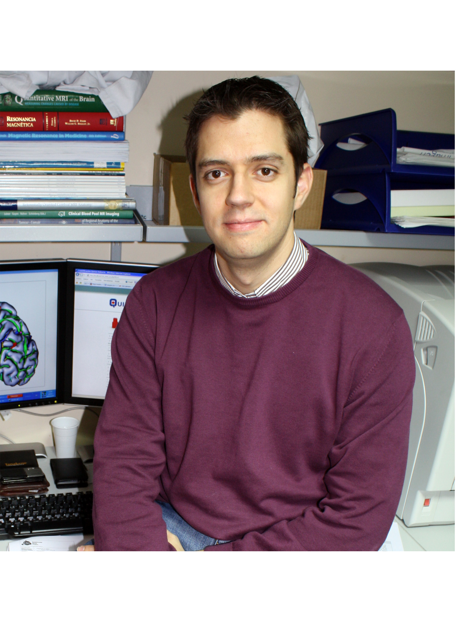 La neuroimagen demuestra que la terapia cognitivo conductual en pacientes con esquizofrenia mejora notablemente la enfermedad