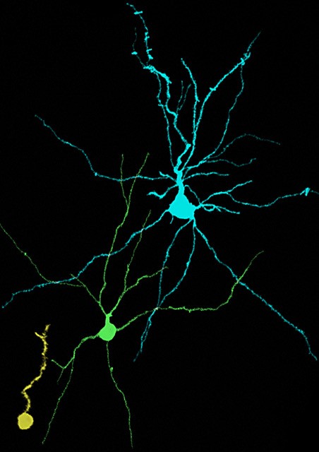 Un estudio desvela una nueva forma de plasticidad neuronal