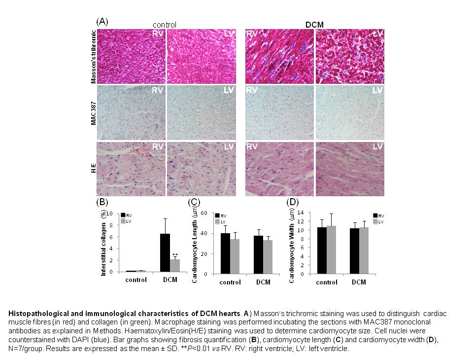 Identificados nuevos biomarcadores asociados con cambios estructurales y metabólicos en los ventrículos en casos de enfermedad cardiovascular