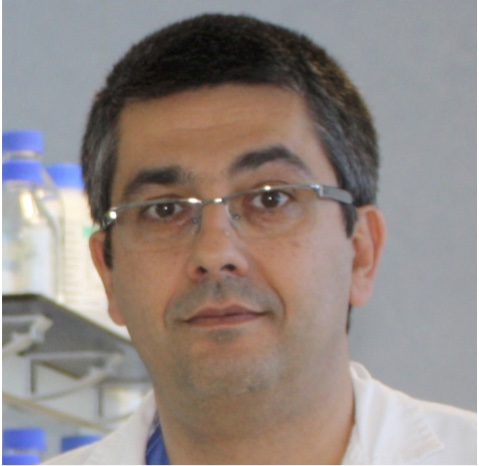 Impacto de la revascularización coronaria percutánea de lesiones coronarias graves en ramas secundarias