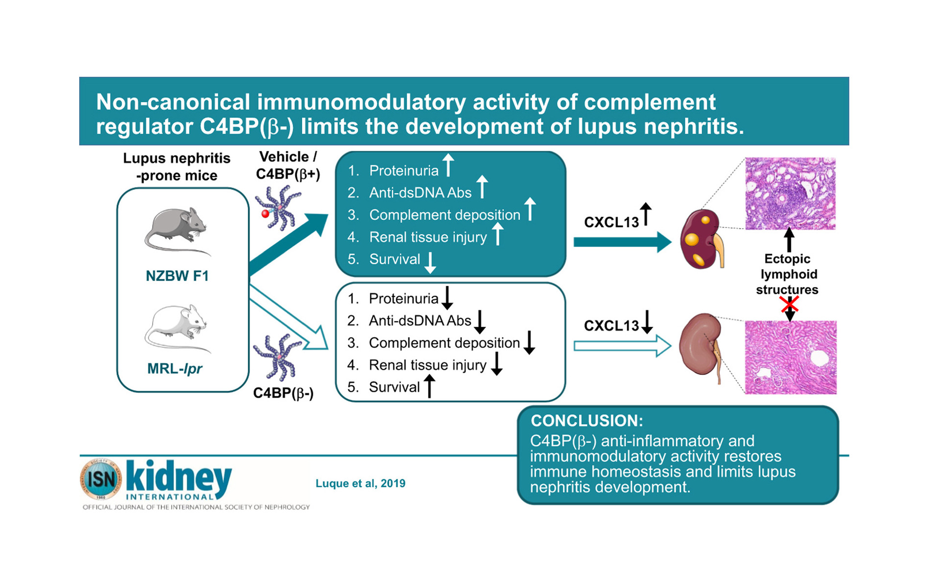 Una molécula de la sangre puede ser efectiva contra la enfermedad autoinmune del riñón