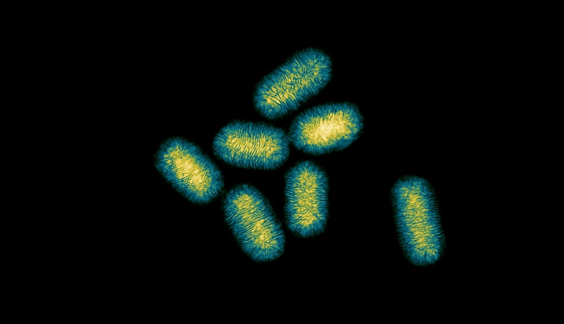 Desvelan un mecanismo para obtener “nanotornillos” metálicos con gran potencial para aplicaciones biomédicas