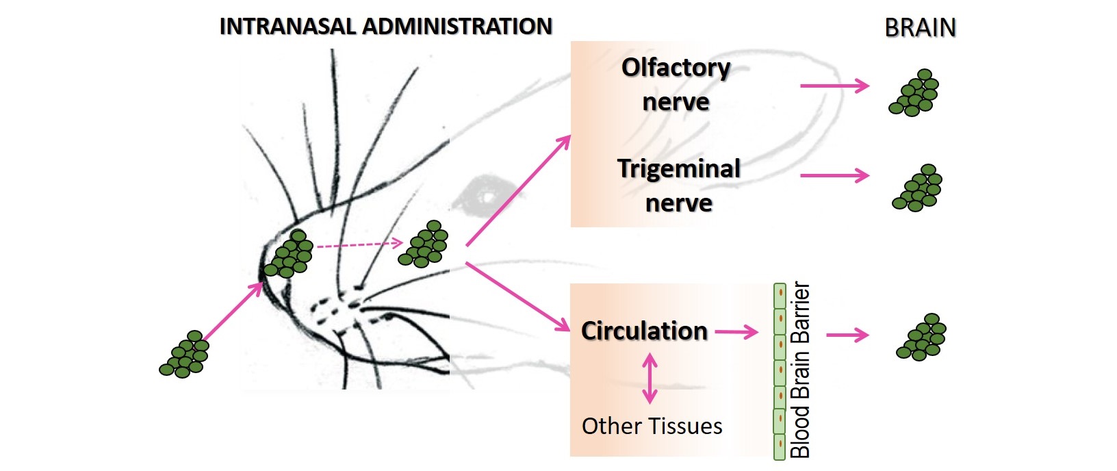Primeros resultados de una nueva vía de administración de tratamiento para el síndrome de Allan-Herndon-Dudley