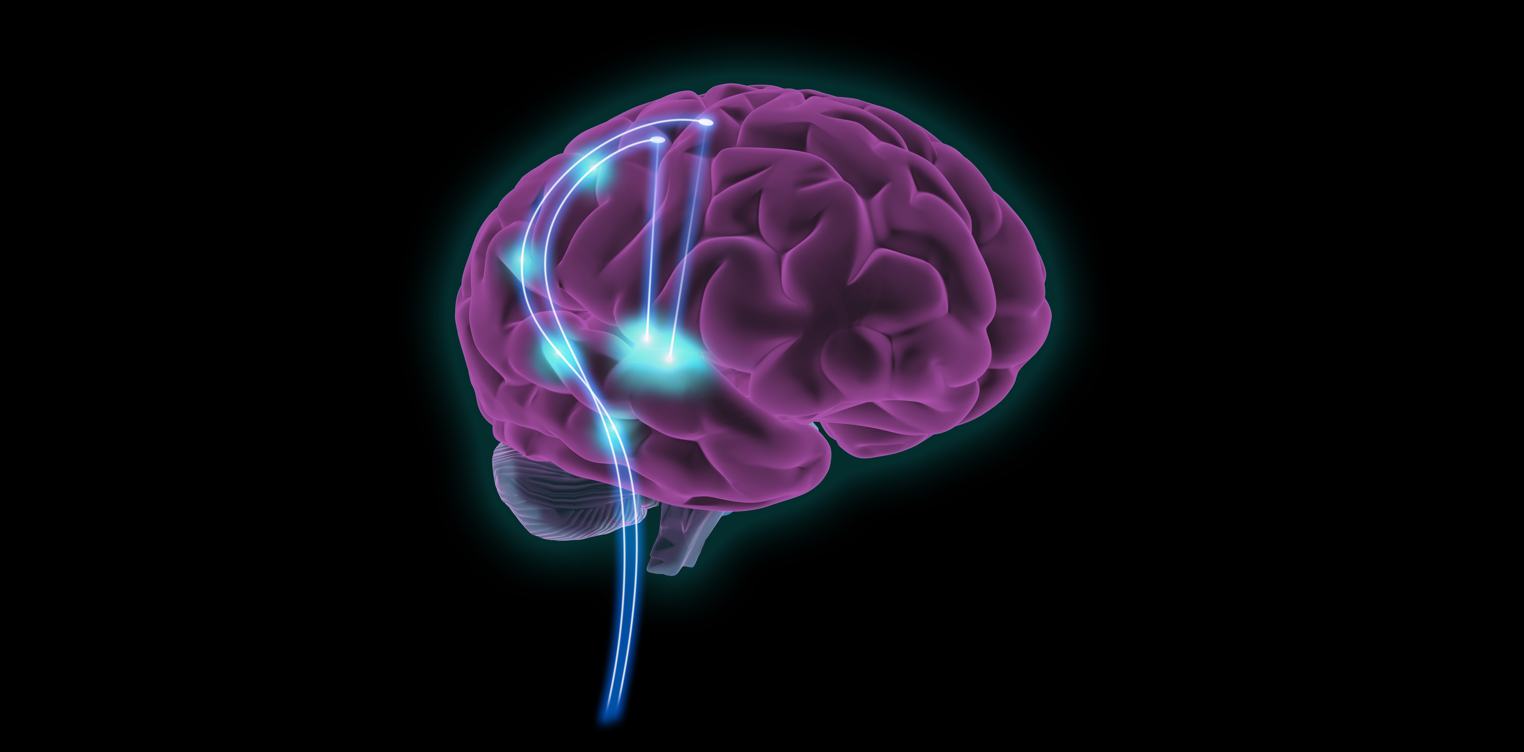 Nuevas sondas neuronales basadas en grafeno mejoran la detección de señales cerebrales epilépticas