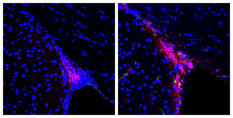 Defectos en la capacidad de migración de las nuevas neuronas podrían causar la pérdida de olfato y otros defectos cognitivos en el Alzheimer