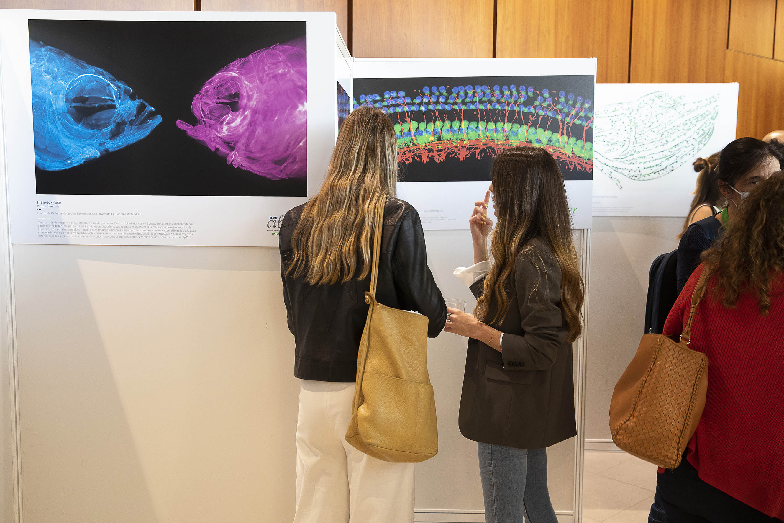 CIBERER inaugura una exposición de fotografía sobre investigación en enfermedades raras