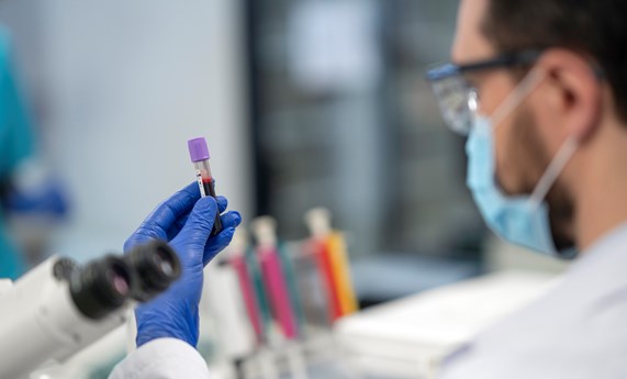 Niveles elevados de GDF15 podrían estar asociados con lesión hepática y aterosclerosis Niveles elevados de GDF15 podrían estar asociados con lesión hepática y aterosclerosis