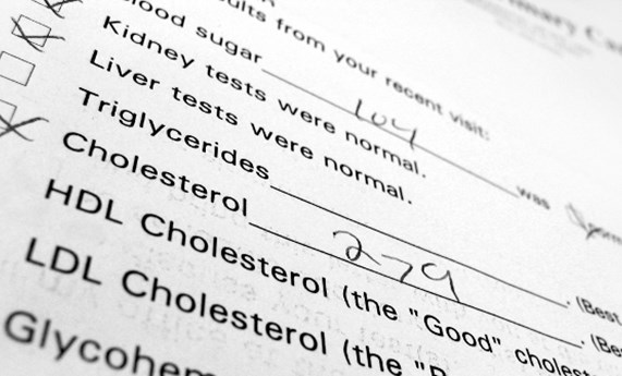 Los niveles de colesterol bueno, claves para atenuar el riesgo cardiovascular Los niveles de colesterol bueno, claves para atenuar el riesgo cardiovascular