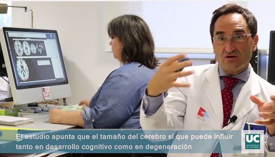 Identificados nuevos genes asociados al volumen del cerebro humano